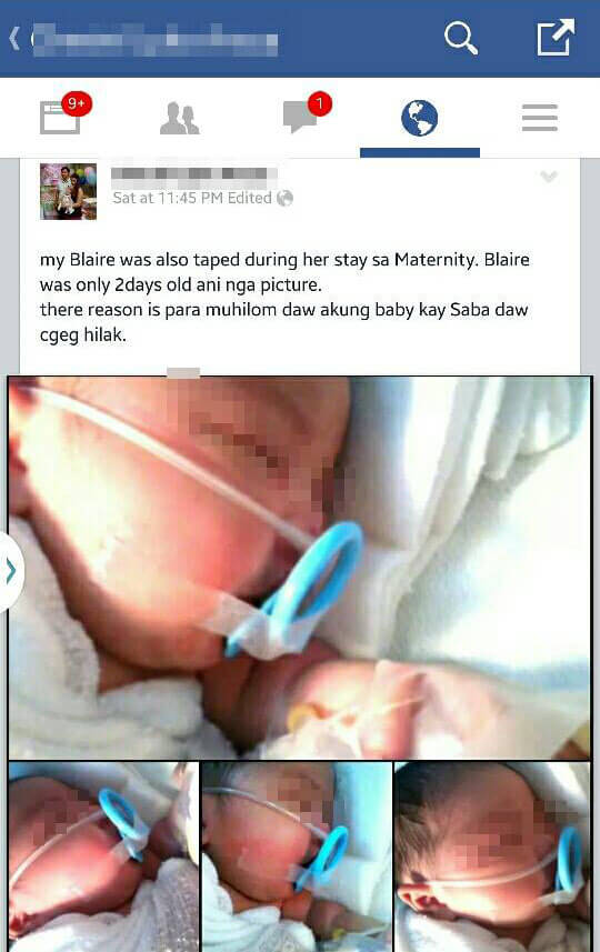 taping of baby