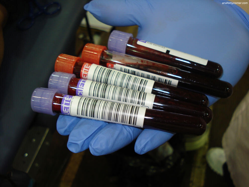 Blood donation
