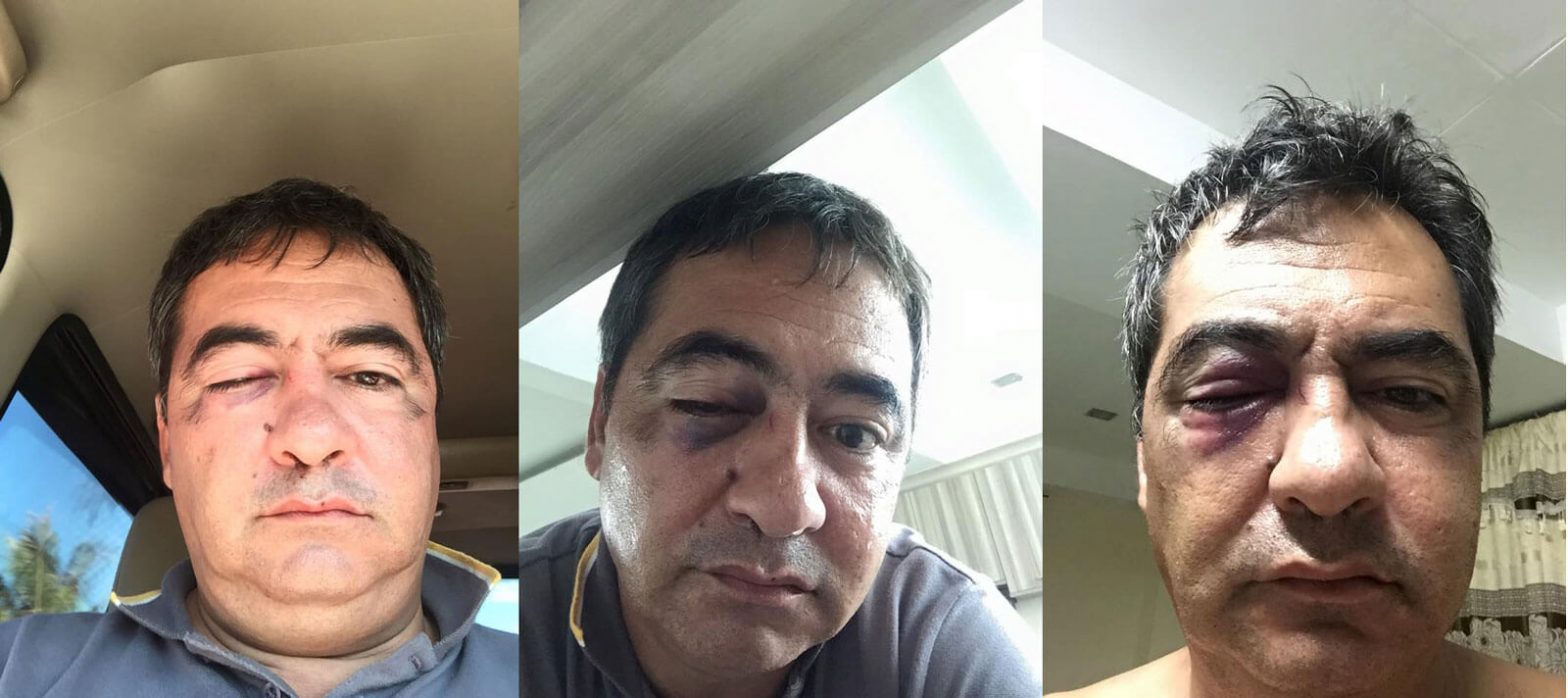 Mayor, ex-Capitol consultant figure in motel brawl; Ex-gov files graft charges vs. Davide; Comelec condcuts final testing on VCMs–Cebu News Digest for May 7, 2016