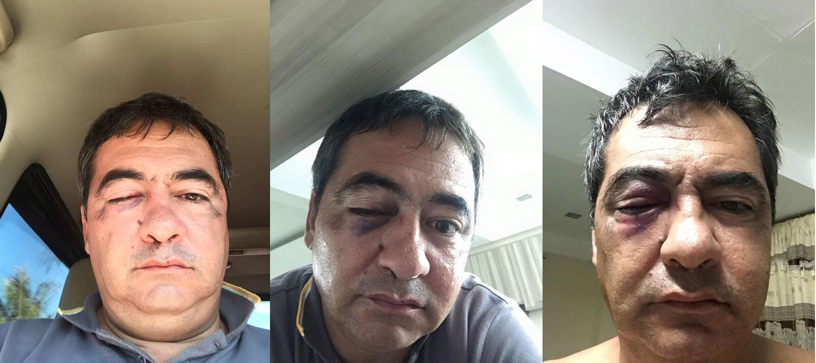 Mayor, ex-Capitol consultant figure in motel brawl; Ex-gov files graft charges vs. Davide; Comelec condcuts final testing on VCMs–Cebu News Digest for May 7, 2016